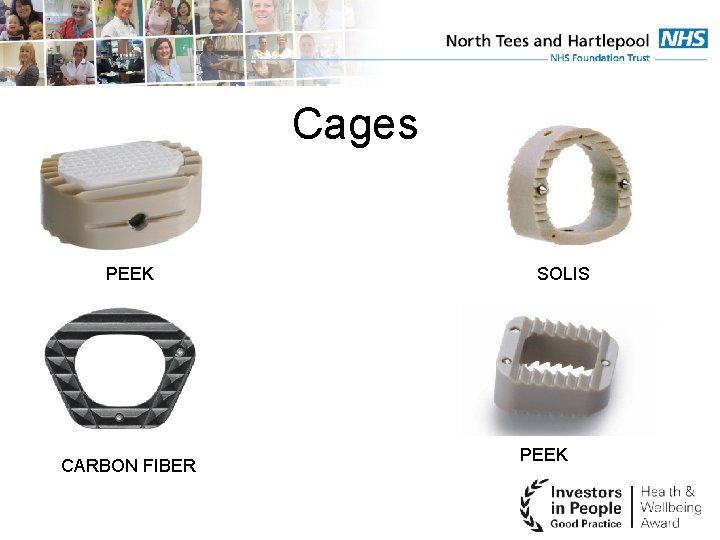 Cages PEEK CARBON FIBER SOLIS PEEK 