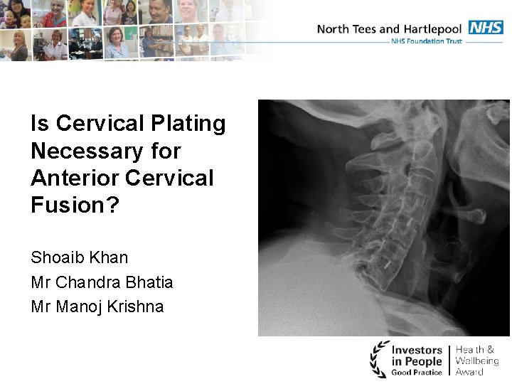 Is Cervical Plating Necessary for Anterior Cervical Fusion? Shoaib Khan Mr Chandra Bhatia Mr