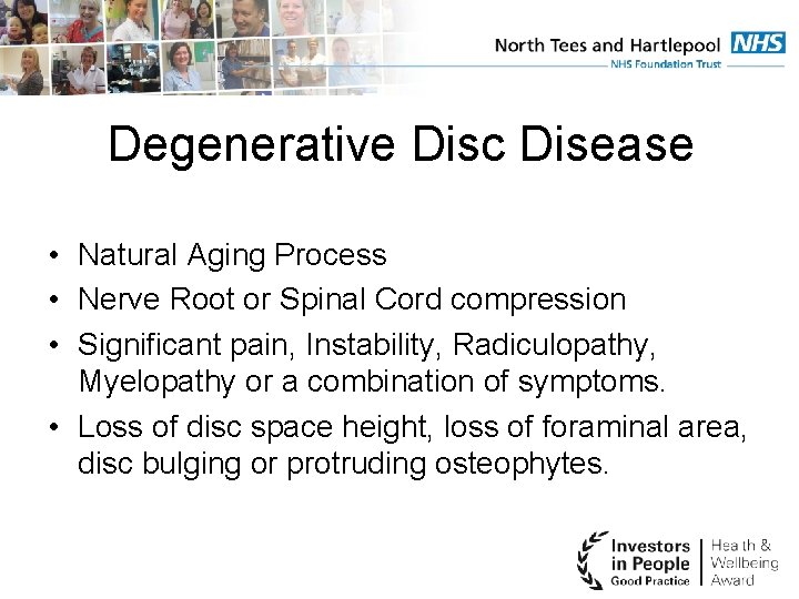  Degenerative Disc Disease • Natural Aging Process • Nerve Root or Spinal Cord