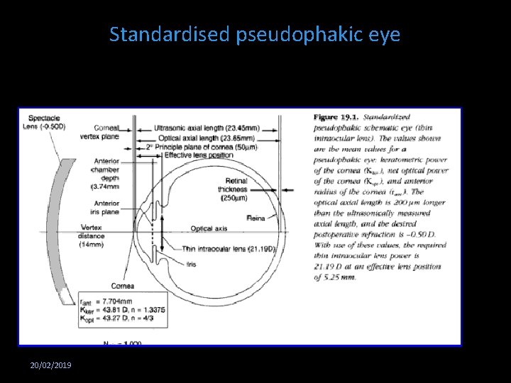 Standardised pseudophakic eye 20/02/2019 