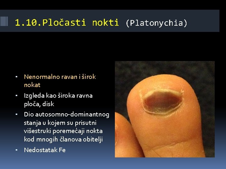 1. 10. Pločasti nokti (Platonychia) ▪ Nenormalno ravan i širok nokat ▪ Izgleda kao