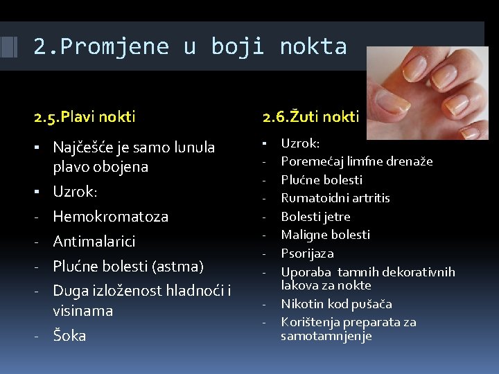 2. Promjene u boji nokta 2. 5. Plavi nokti 2. 6. Žuti nokti ▪