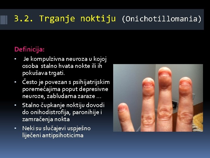 3. 2. Trganje noktiju (Onichotillomania) Definicija: ▪ Je kompulzivna neuroza u kojoj osoba stalno