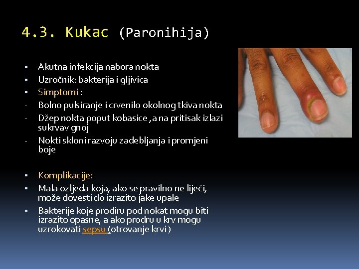 4. 3. Kukac (Paronihija) ▪ ▪ ▪ - ▪ ▪ ▪ Akutna infekcija nabora