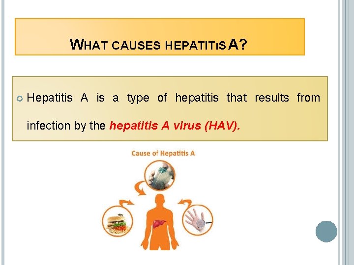 WHAT CAUSES HEPATITıS A? Hepatitis A is a type of hepatitis that results from