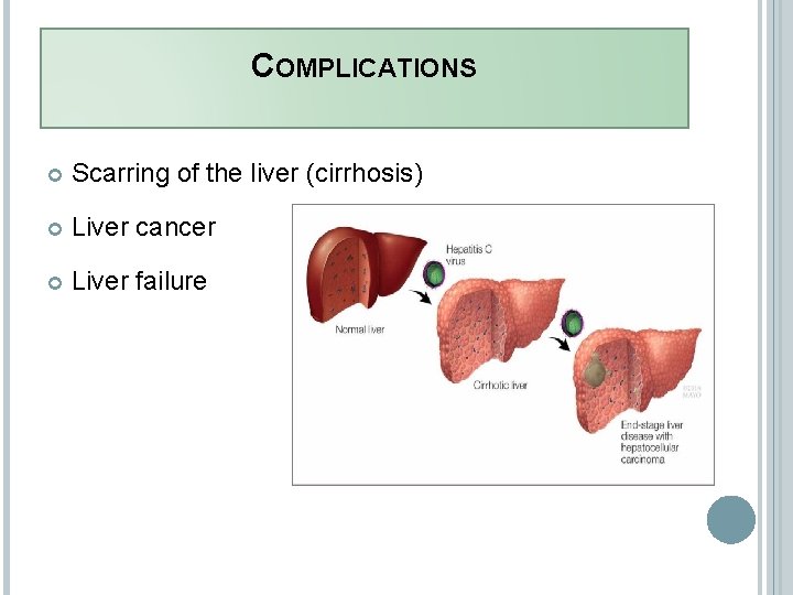 COMPLICATIONS Scarring of the liver (cirrhosis) Liver cancer Liver failure 