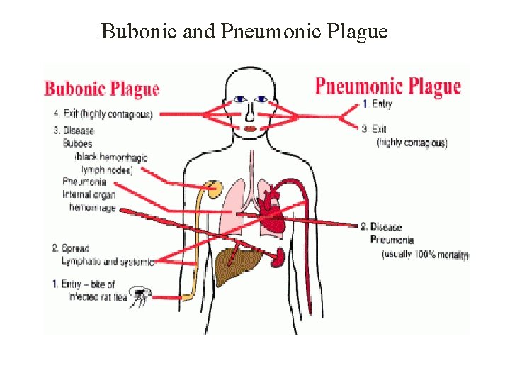 Bubonic and Pneumonic Plague 
