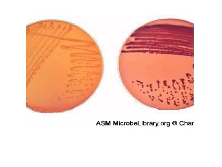 Lactose fermentation on Mac. Conkey agar 