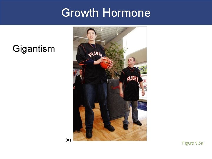 Growth Hormone Gigantism Figure 9. 5 a 