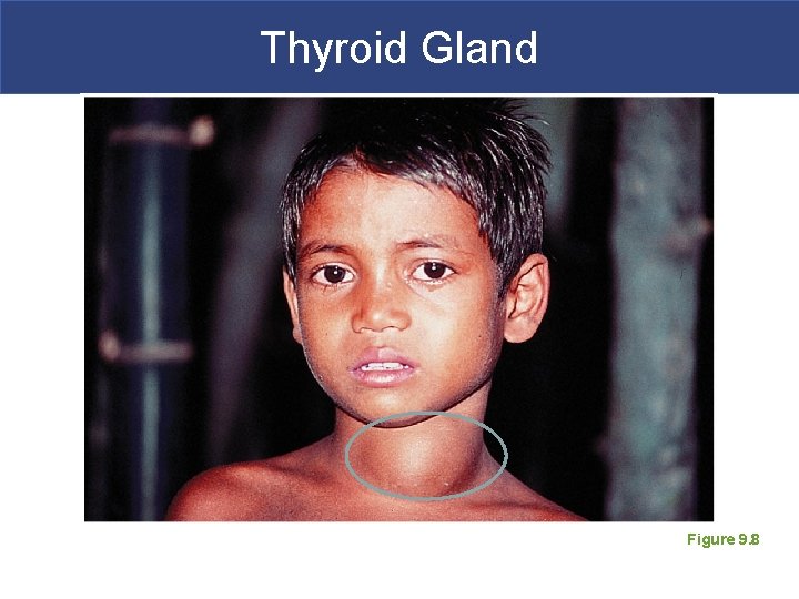 Thyroid Gland Figure 9. 8 