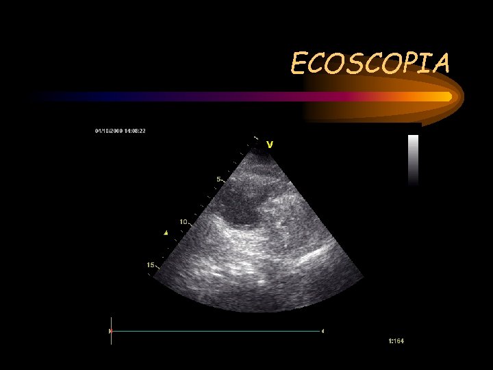 ECOSCOPIA 