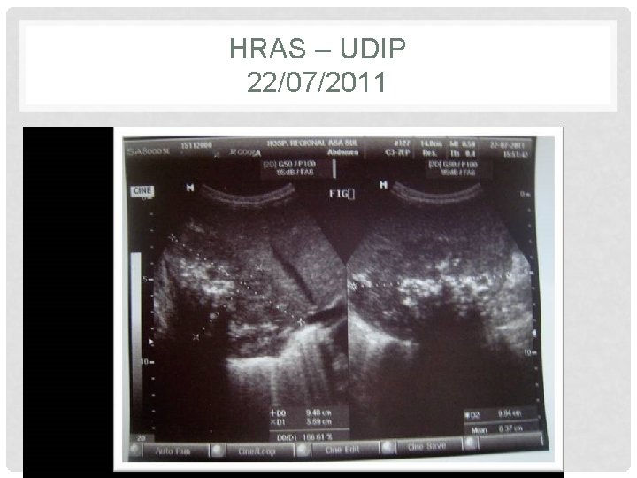 HRAS – UDIP 22/07/2011 