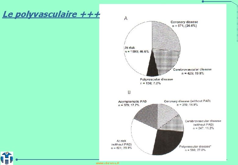 Le polyvasculaire +++ www. chu-nice. fr 