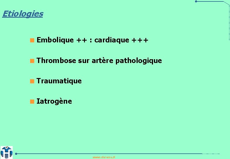 Etiologies < Embolique ++ : cardiaque +++ < Thrombose sur artère pathologique < Traumatique