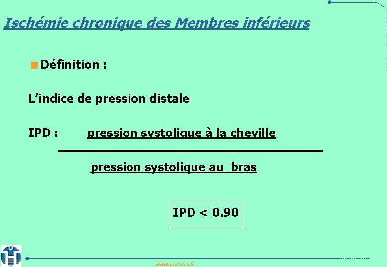 Ischémie chronique des Membres inférieurs <Définition : L’indice de pression distale IPD : pression