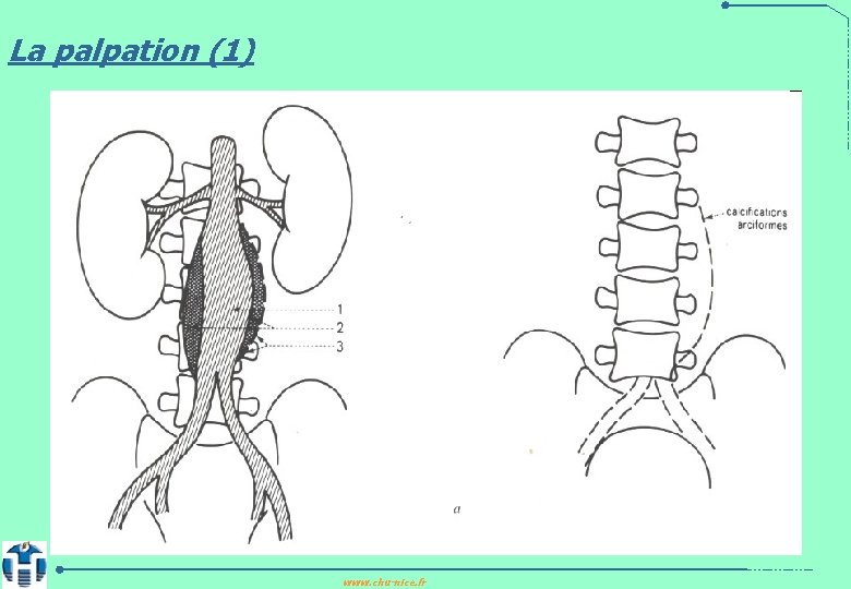 La palpation (1) www. chu-nice. fr 