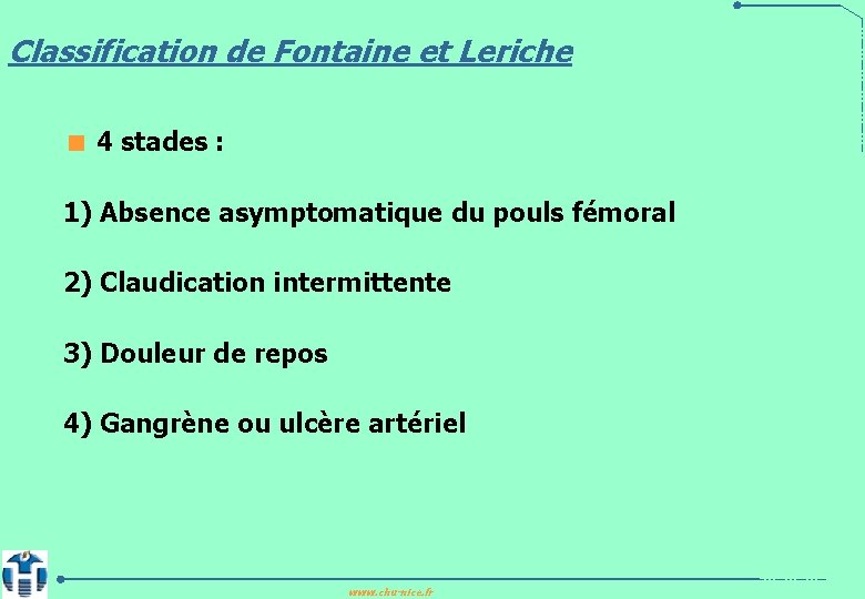 Classification de Fontaine et Leriche < 4 stades : 1) Absence asymptomatique du pouls