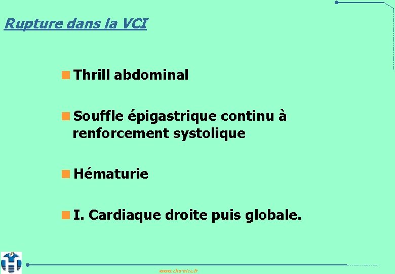 Rupture dans la VCI <Thrill abdominal <Souffle épigastrique continu à renforcement systolique <Hématurie <I.