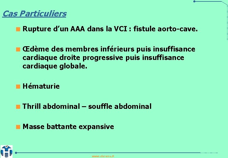 Cas Particuliers < Rupture d’un AAA dans la VCI : fistule aorto-cave. < Œdème