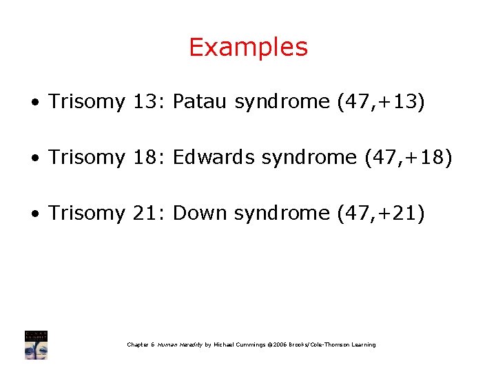 Examples • Trisomy 13: Patau syndrome (47, +13) • Trisomy 18: Edwards syndrome (47,