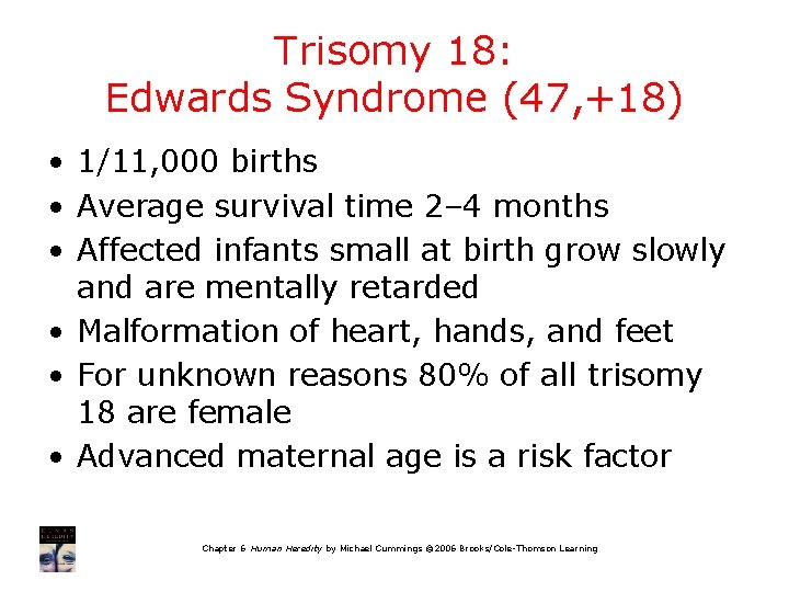 Trisomy 18: Edwards Syndrome (47, +18) • 1/11, 000 births • Average survival time