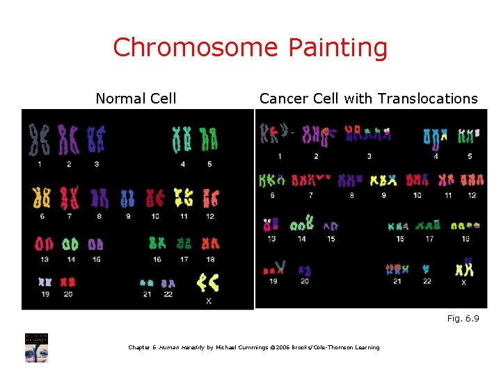 Chromosome Painting Normal Cell Cancer Cell with Translocations Fig. 6. 9 Chapter 6 Human
