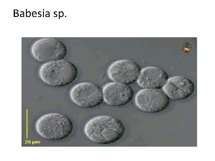 Babesia sp. 