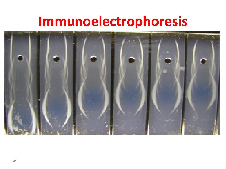 Immunoelectrophoresis 41 