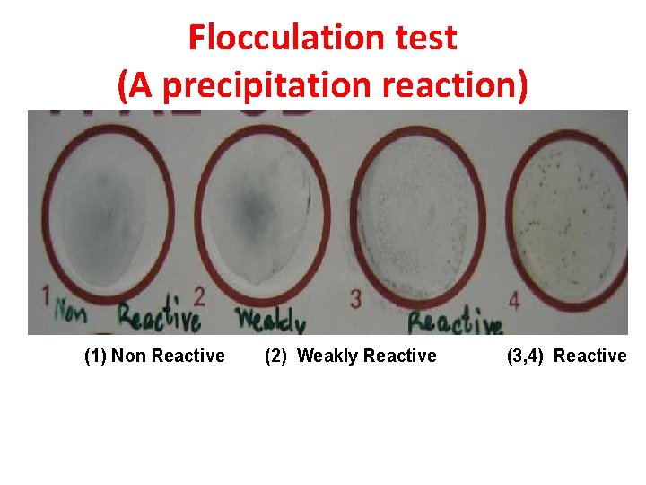 Flocculation test (A precipitation reaction) (1) Non Reactive (2) Weakly Reactive (3, 4) Reactive