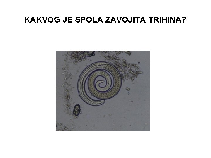 KAKVOG JE SPOLA ZAVOJITA TRIHINA? 