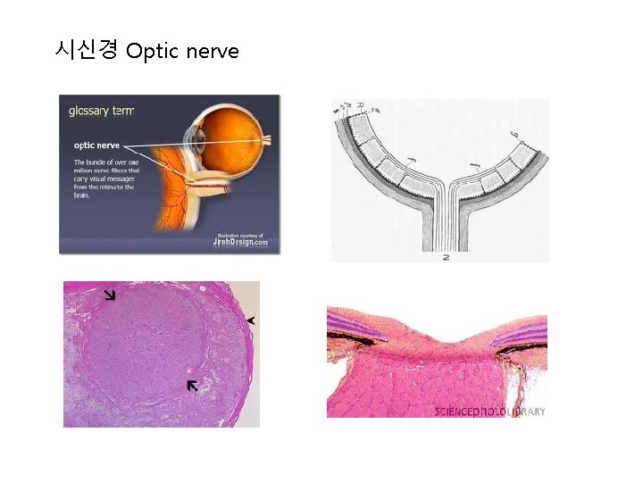 시신경 Optic nerve 