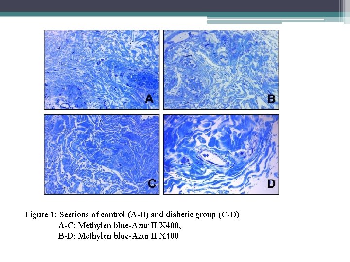 Figure 1: Sections of control (A-B) and diabetic group (C-D) A-C: Methylen blue-Azur II