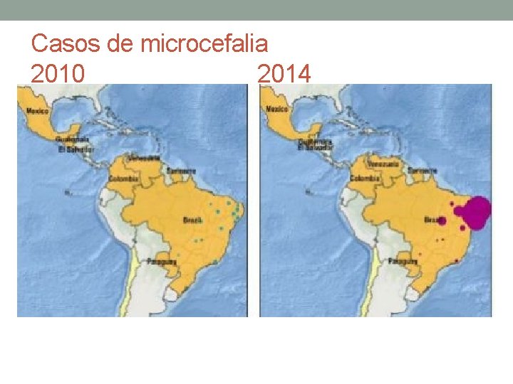 Casos de microcefalia 2010 2014 