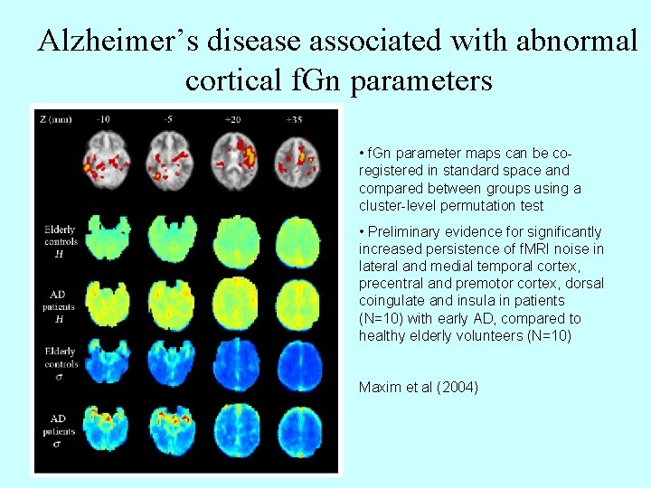 Alzheimer’s disease associated with abnormal cortical f. Gn parameters • f. Gn parameter maps