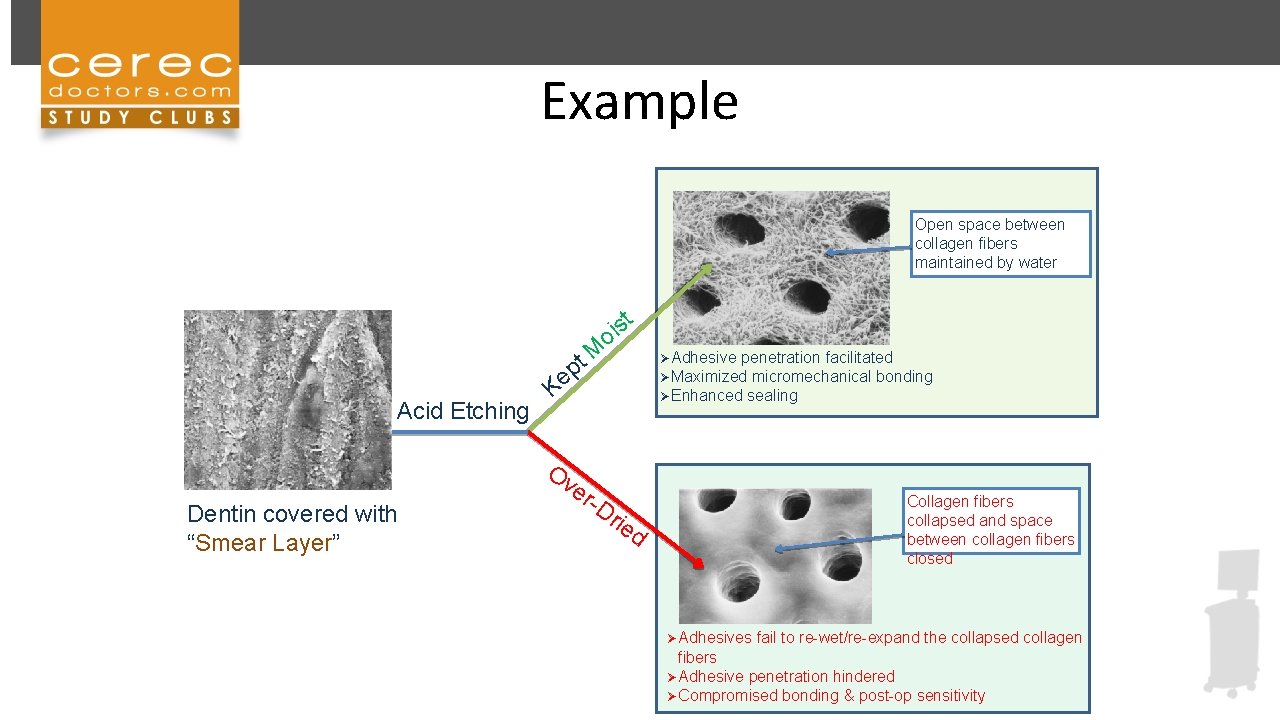 Example Open space between collagen fibers maintained by water st i o M t