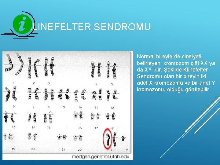KLINEFELTER SENDROMU Normal bireylerde cinsiyeti belirleyen kromozom çifti XX ya da XY ‘dir. Şekilde