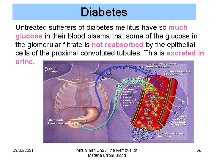 Diabetes Untreated sufferers of diabetes mellitus have so much glucose in their blood plasma