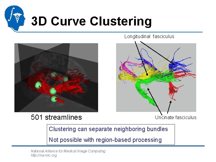 3 D Curve Clustering Longitudinal fasciculus 501 streamlines Uncinate fasciculus Clustering can separate neighboring