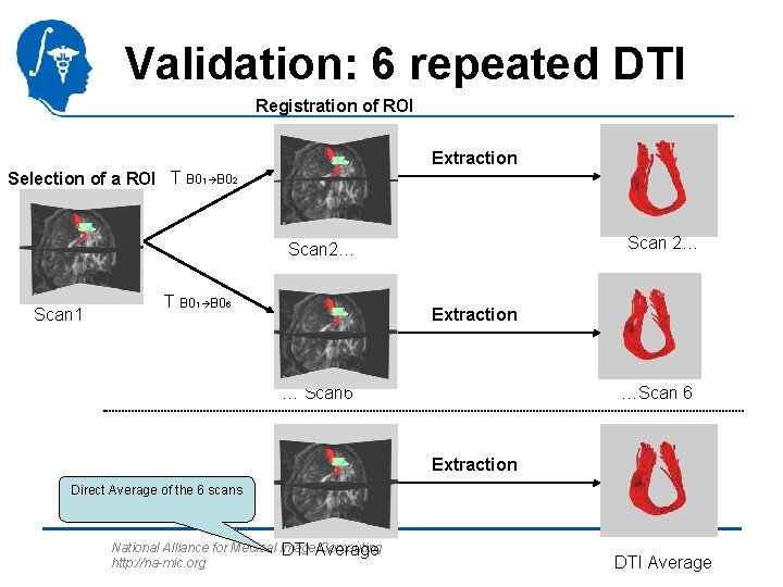 Validation: 6 repeated DTI Registration of ROI Extraction Selection of a ROI T B