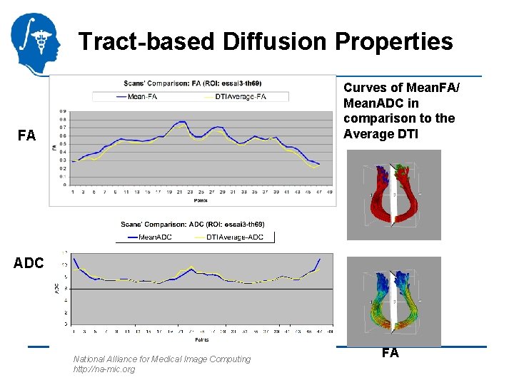 Tract-based Diffusion Properties Curves of Mean. FA/ Mean. ADC in comparison to the Average