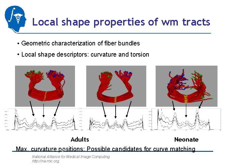 Local shape properties of wm tracts • Geometric characterization of fiber bundles • Local