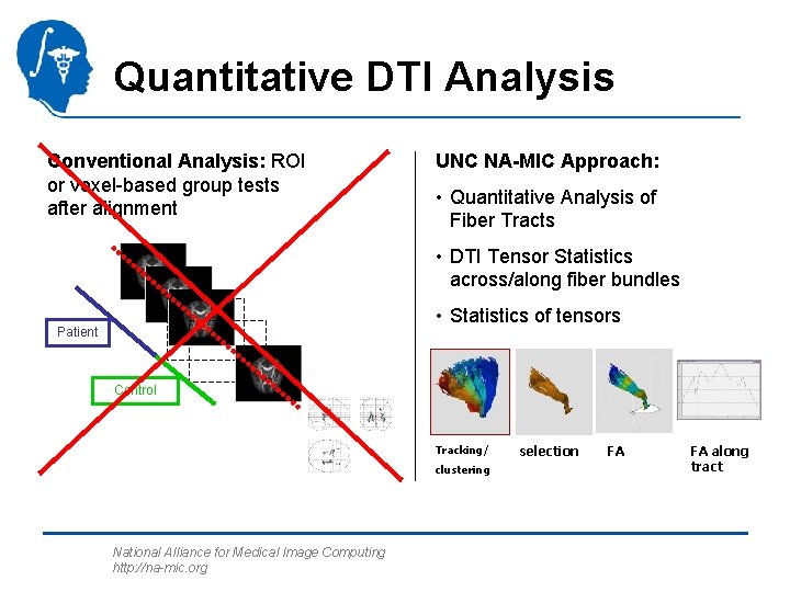 Quantitative DTI Analysis Conventional Analysis: ROI or voxel-based group tests after alignment UNC NA-MIC