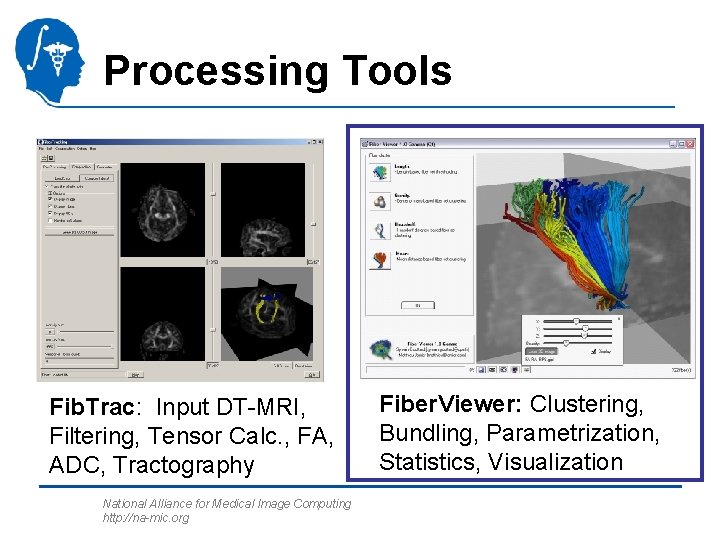 Processing Tools Fib. Trac: Input DT-MRI, Filtering, Tensor Calc. , FA, ADC, Tractography National