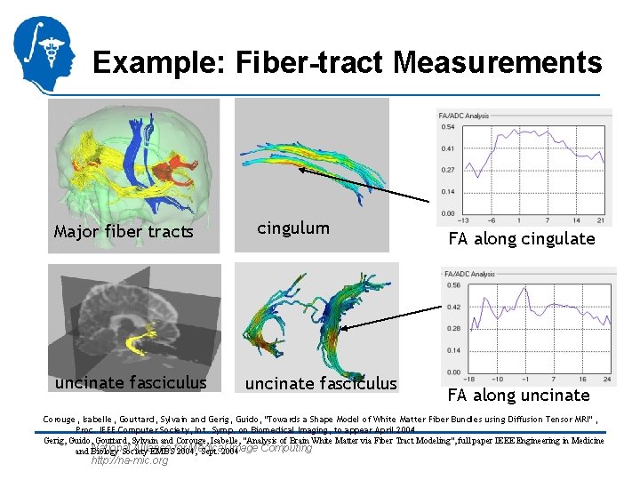 Example: Fiber-tract Measurements Major fiber tracts uncinate fasciculus cingulum uncinate fasciculus FA along cingulate