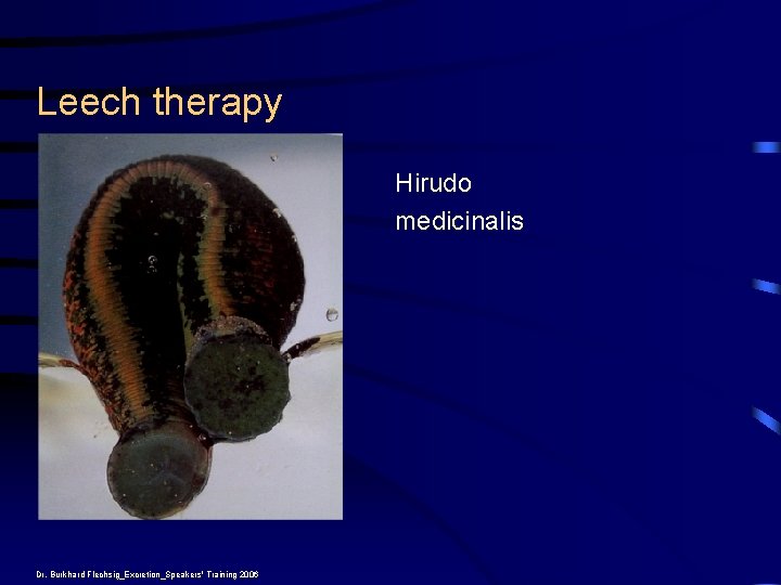 Leech therapy Hirudo medicinalis Dr. Burkhard Flechsig_Excretion_Speakers' Training 2006 