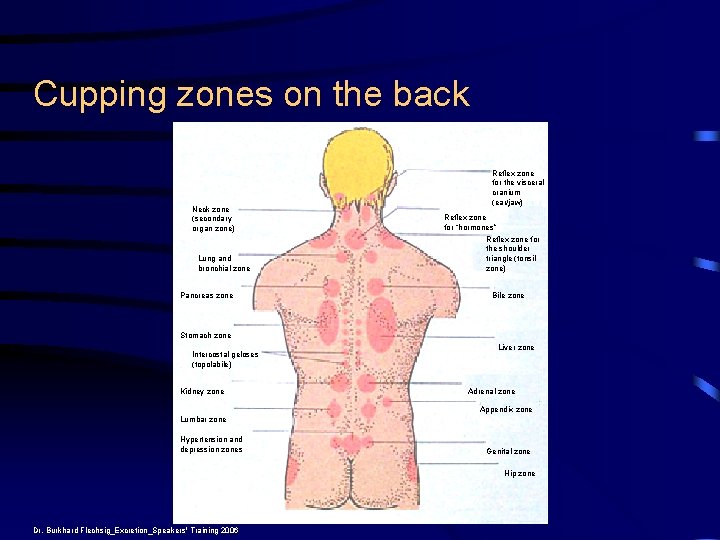 Cupping zones on the back Neck zone (secondary organ zone) Lung and bronchial zone