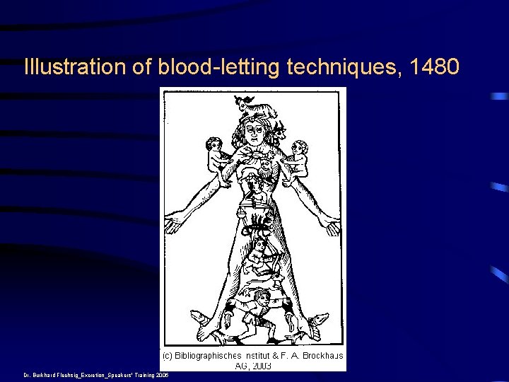 Illustration of blood-letting techniques, 1480 Dr. Burkhard Flechsig_Excretion_Speakers' Training 2006 