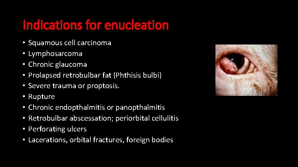 Indications for enucleation • • • Squamous cell carcinoma Lymphosarcoma Chronic glaucoma Prolapsed retrobulbar