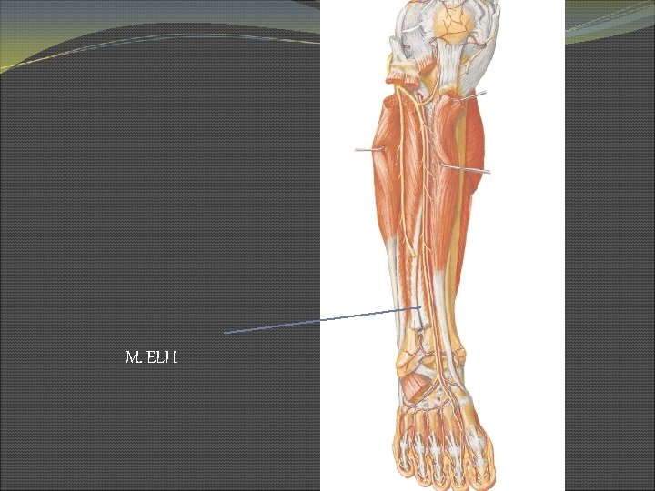 M. ELH 