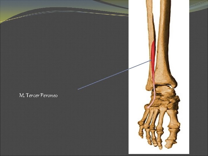 M. Tercer Peroneo 